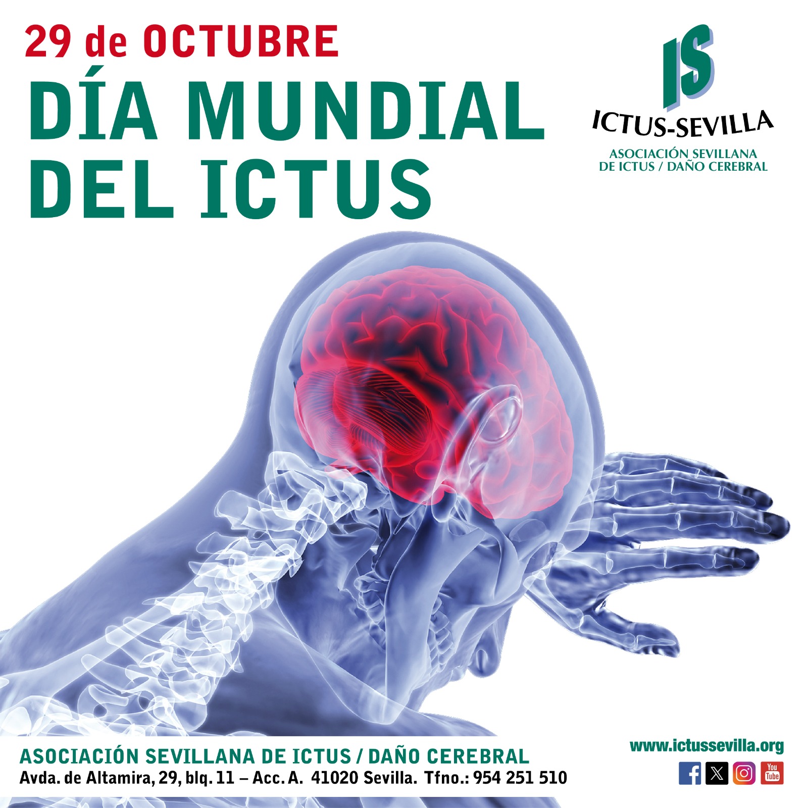 DÍA MUNDIAL DEL ICTUS
