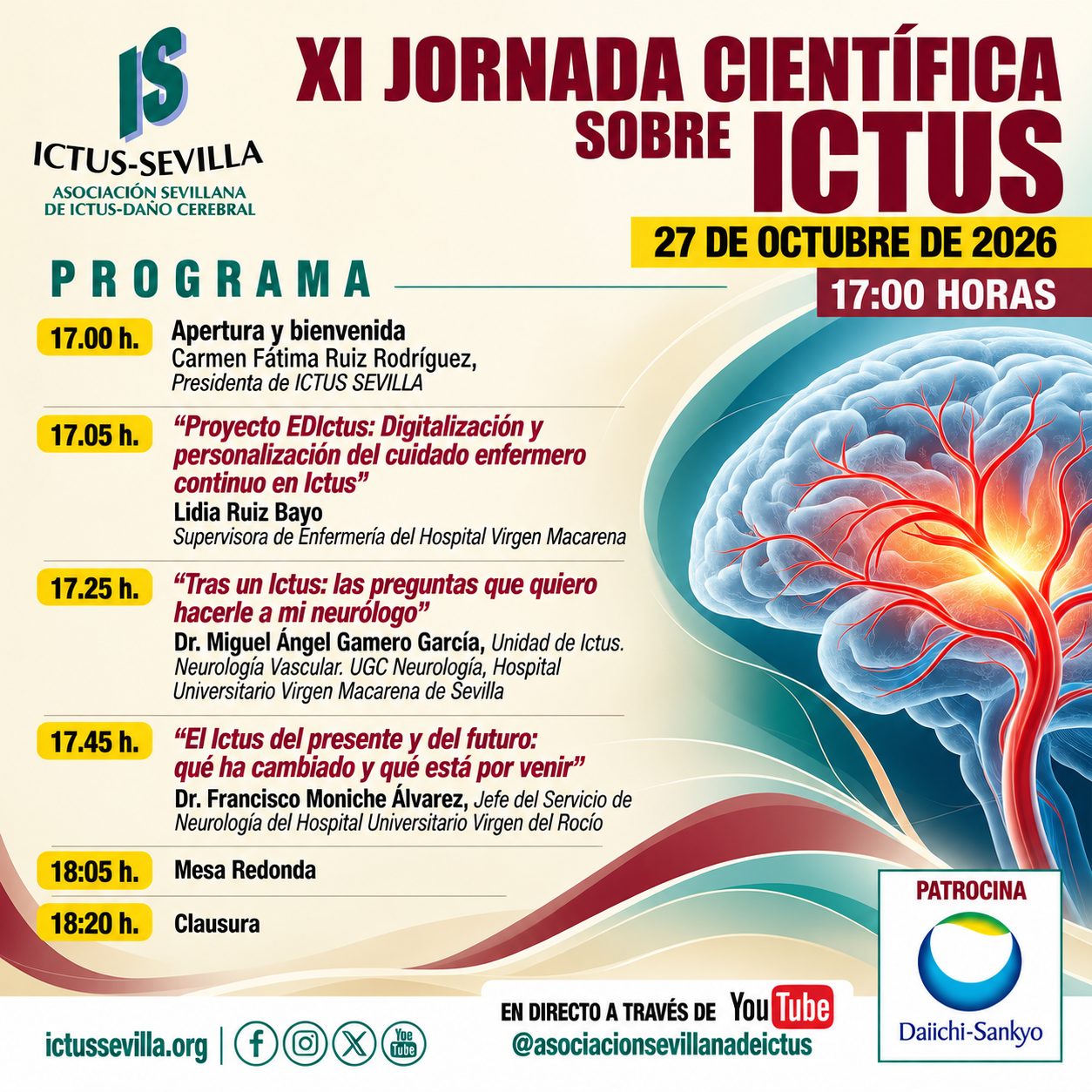 XI Jornada Científica sobre Ictus